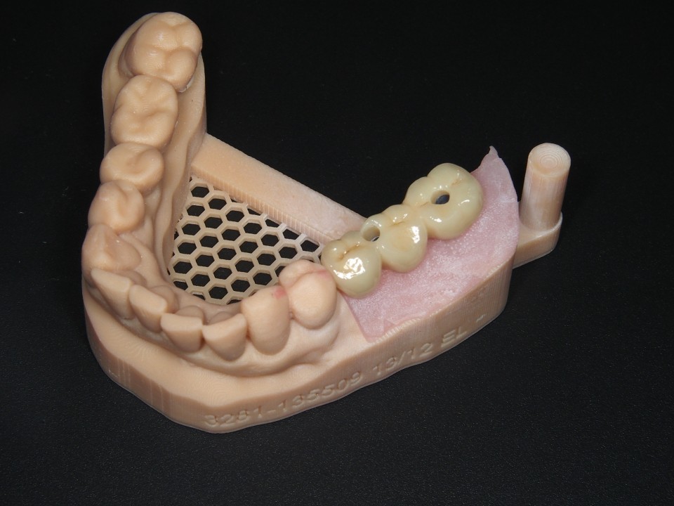 3 brug op het model geschroefd ter controle