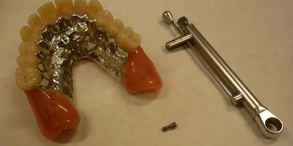 11 klikgebit prothese met schroeven
