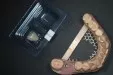 Implantaatkroon grote kies onder